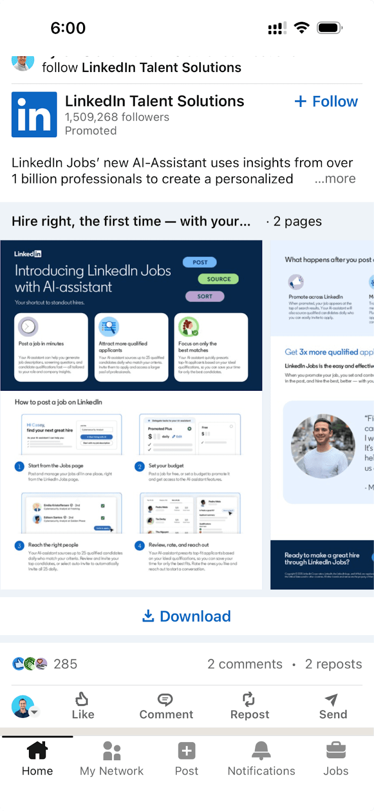 TODO: describe image for How to See Scheduled Posts on LinkedIn — Mobile